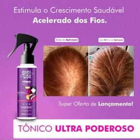 Kit HidraCaps + Tônico