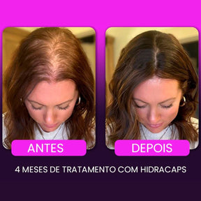 Kit HidraCaps + Tônico